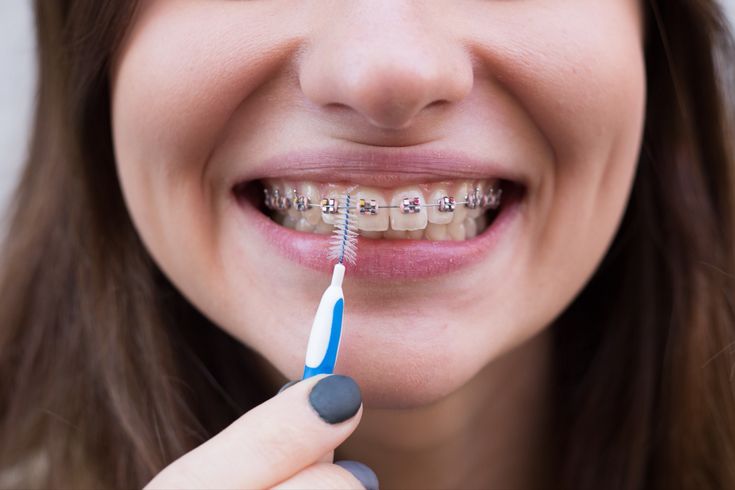How to Choose the Right Toothbrush