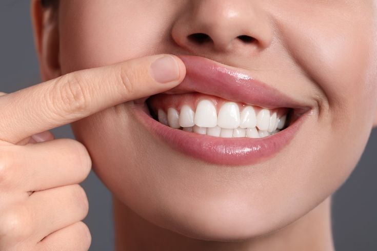 Why Healthy Enamel Matters